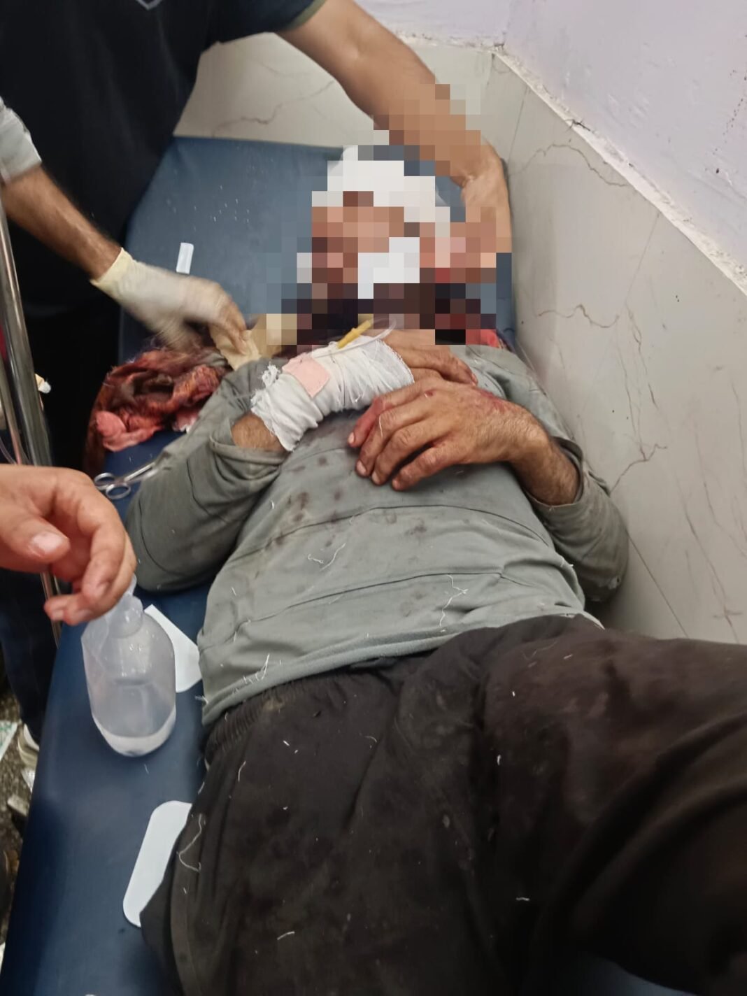 Man injured critically in bear attack at Chatroo