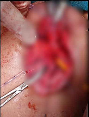 From Hope to Healing: AIIMS Jammu’s Remarkable Journey in Child Surgery and Diagnostics